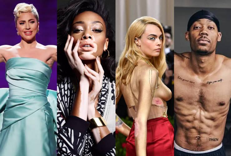 Gaga, Winnie, Cara e Tyler