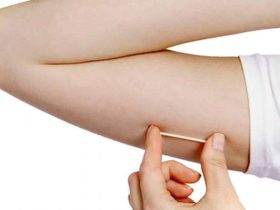 Implante contraceptivo