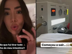 Print do story de Adriana Sant'Anna ao optar por hidrocolonterapia para alívio abdominal