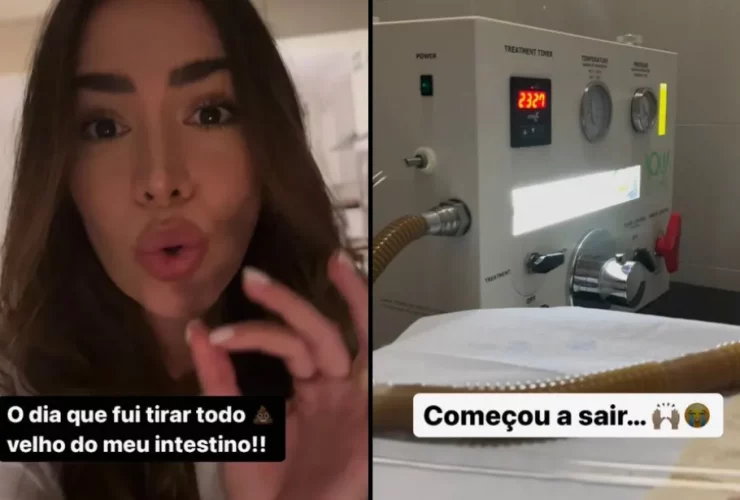 Print do story de Adriana Sant'Anna ao optar por hidrocolonterapia para alívio abdominal