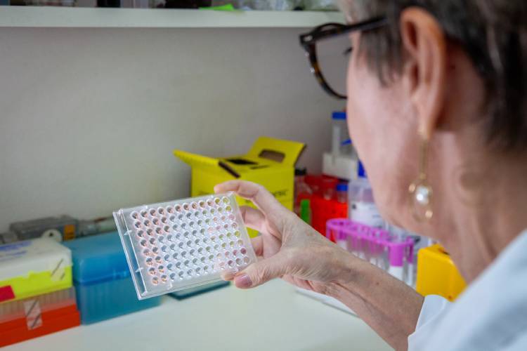 A pesquisadora Ana Lucia mostrando exemplos com leptospirose para pesquisa Fotos: José Felipe Batista/Comunicação Butantan