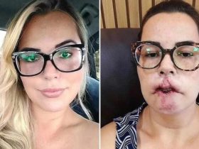 Antes e depois de Mariana Michelini