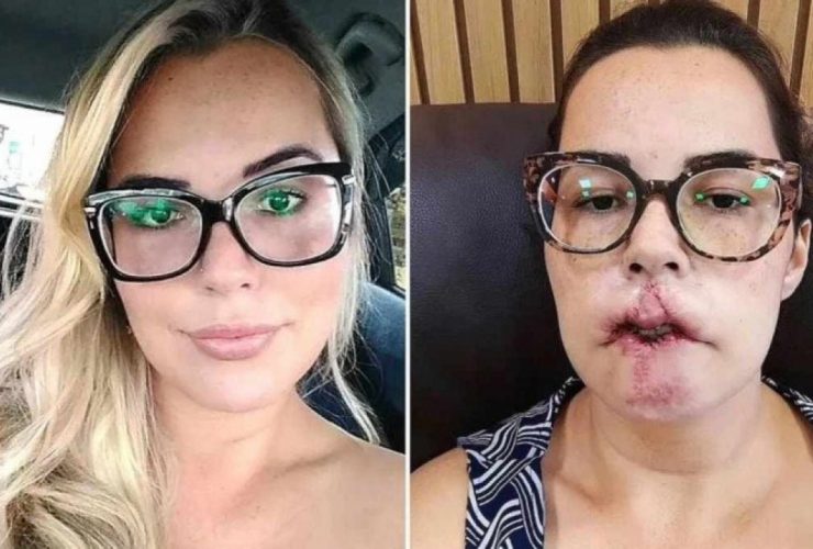 Antes e depois de Mariana Michelini