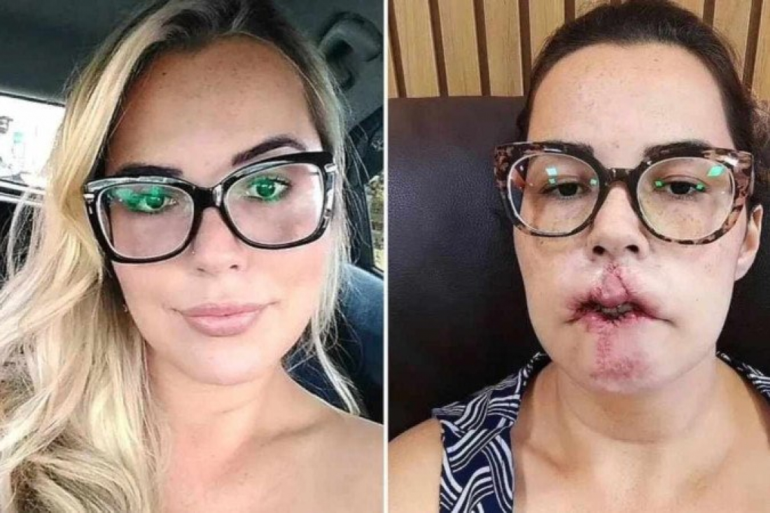 Antes e depois de Mariana Michelini