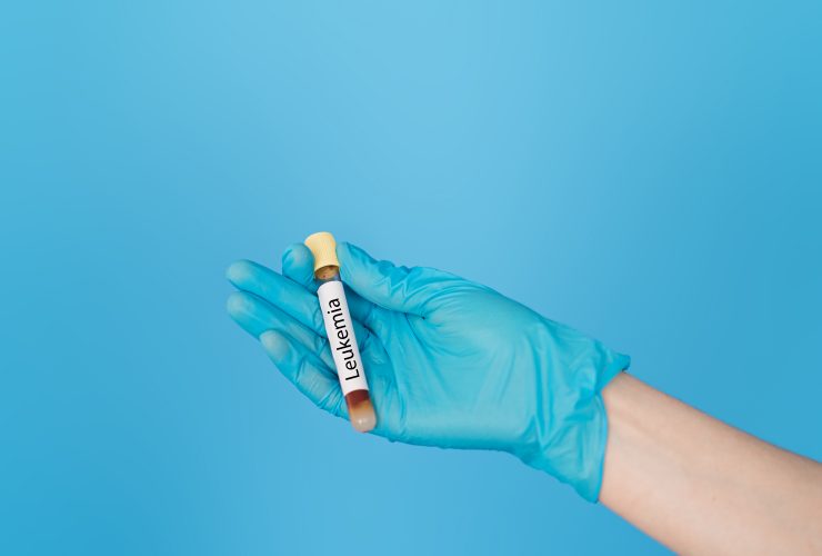 Mão segurando o tubo de ensaio de sangue com a inscrição leucemia Por Nestea06