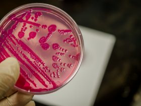 Placa de cultura bacteriana Por manjurulhaque