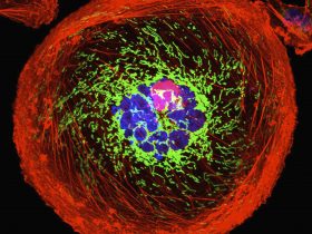 Imagem microscópica de célula cancerosa gigante poliplóide Por Image-Source