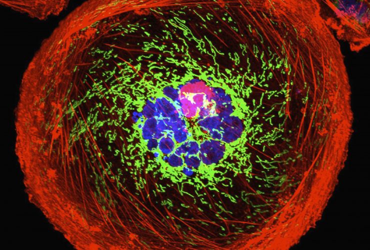 Imagem microscópica de célula cancerosa gigante poliplóide Por Image-Source