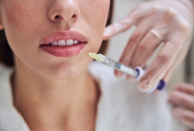 Mulher encantadora fazendo contorno da boca com injeção de preenchimento Por Iakobchuk
