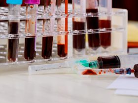 Tubos de ensaio cheios de sangue em laboratório para pesquisa em microtubos Por photovs