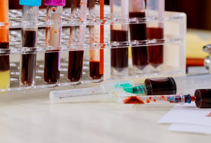 Tubos de ensaio cheios de sangue em laboratório para pesquisa em microtubos Por photovs