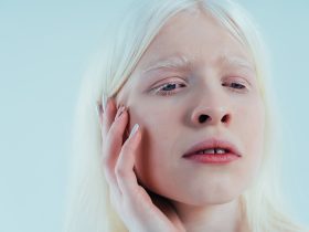 Imagem de beleza de um albino Por oneinchpunchphotos