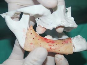 Resultado da reconstrução em 3D Foto: divulgação da Agência Pará