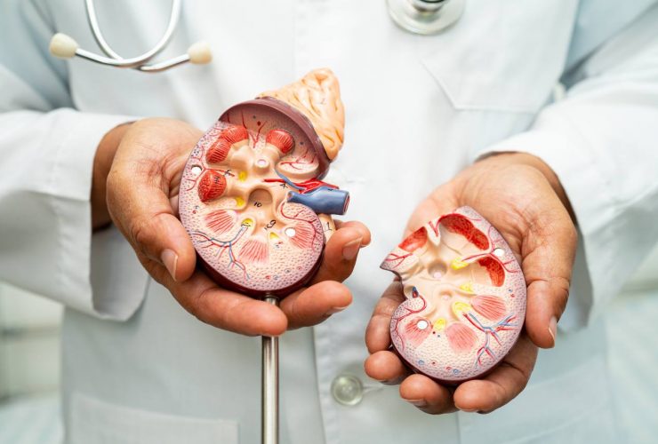 Doença renal, doença renal crônica ckd, médico com modelo humano para estudar e tratar no hospital. Por chormail